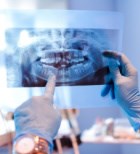 באילו מקרים מטפל רופא שיניים מומחה לכירורגיית פה ולסת?-תמונה
